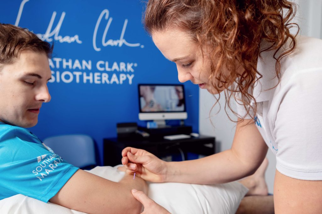 Acupuncture for Raynaud’s! 9 JClarkPhysio 107 1024x683 1