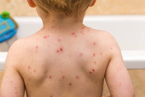 istockphoto 489634516 612x612 1